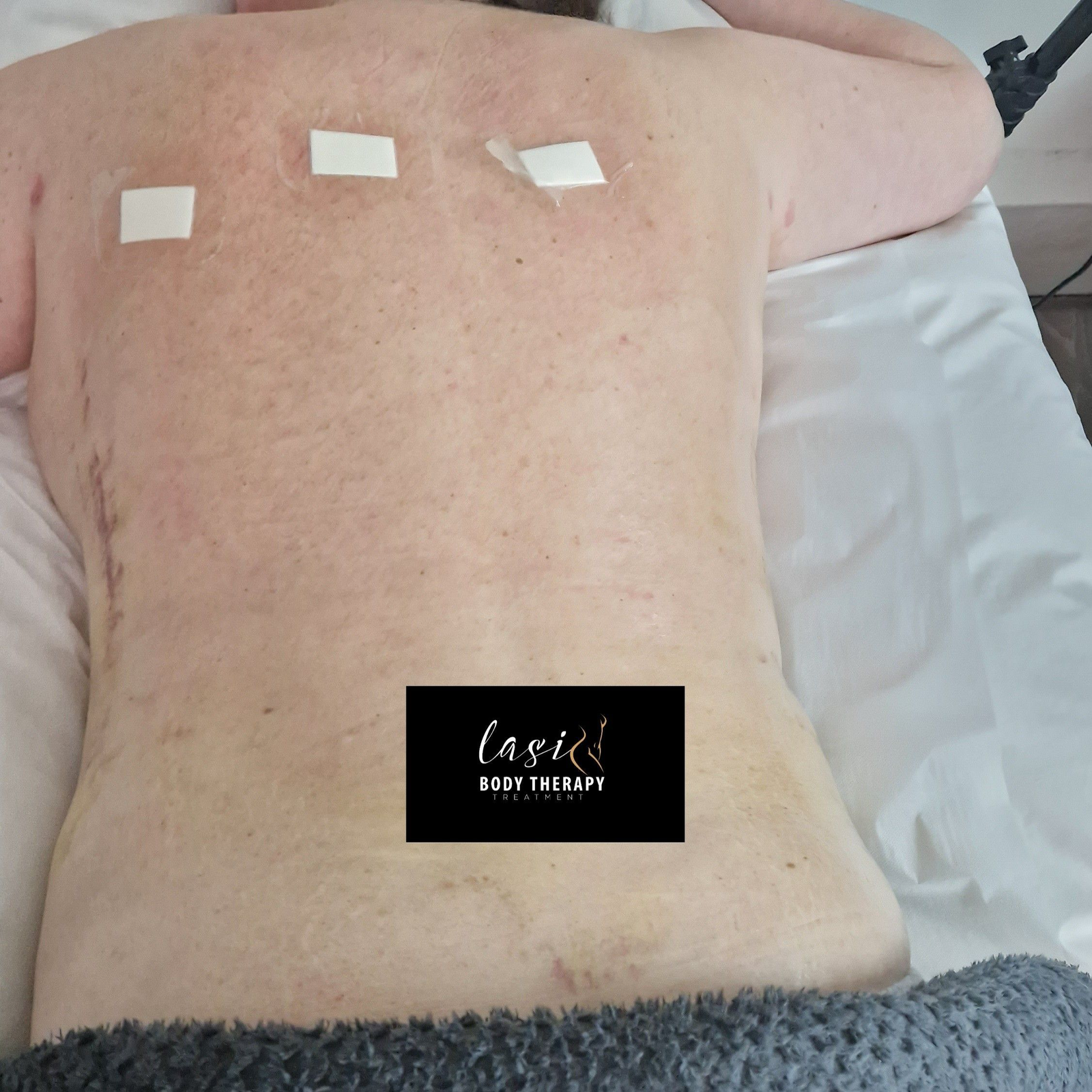 post lymphatic-drainage treatment